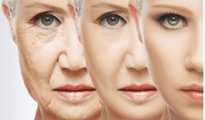 anti aging creams, wrinkles